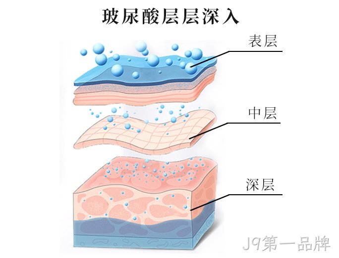 玻尿酸3.png